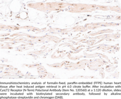 CysLT<sub>2</sub> Receptor (N-<wbr/>Term) Polyclonal Antibody