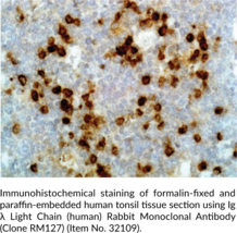 Ig? Light Chain (human) Rabbit Monoclonal Antibody