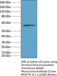 Terminal Deoxynucleotidyl Transferase Rabbit Monoclonal Antibody
