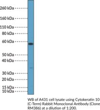 Cytokeratin 10 (C-Term) Rabbit Monoclonal Antibody